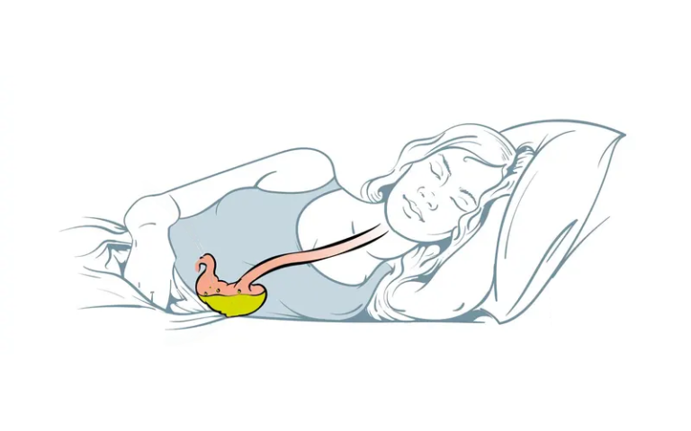 Jak spanie na lewym boku pozytywnie wpływa na zdrowie?